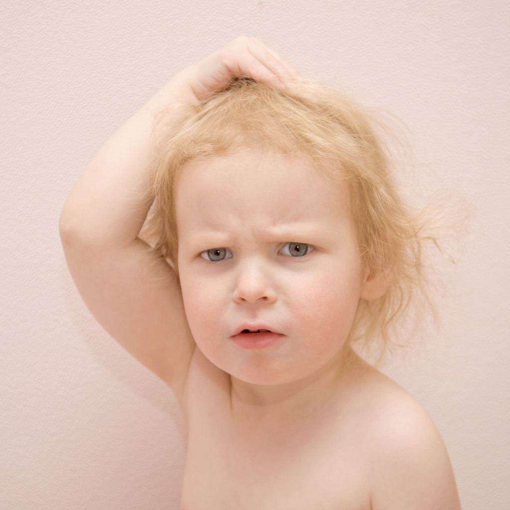 Low Vitamin D, Eczema & Allergies Dr. Gaila Online